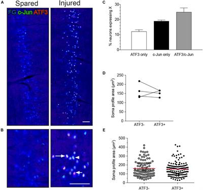 Axonal Injury Induces ATF3 in Specific Populations of Sacral Preganglionic Neurons in Male Rats